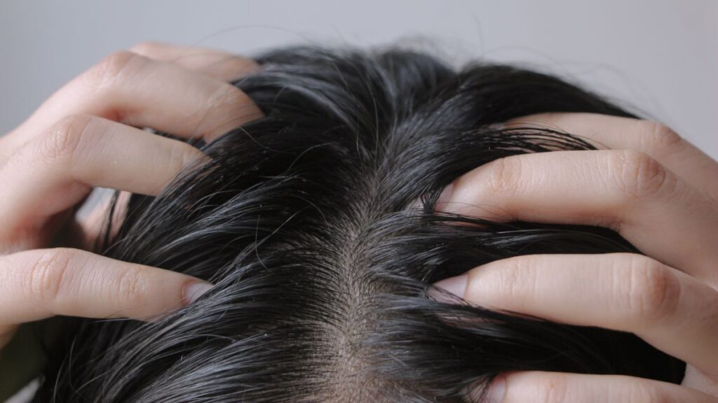 Scalp health back to school guide pembroke pines, broward county