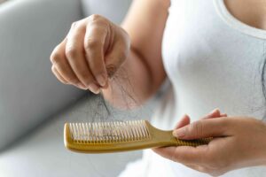 Hair loss treatment near me. Scalp treatment Broward county.