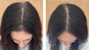 Scalp care and hair treatment at Hair Culture Day Spa in Pembroke Pines